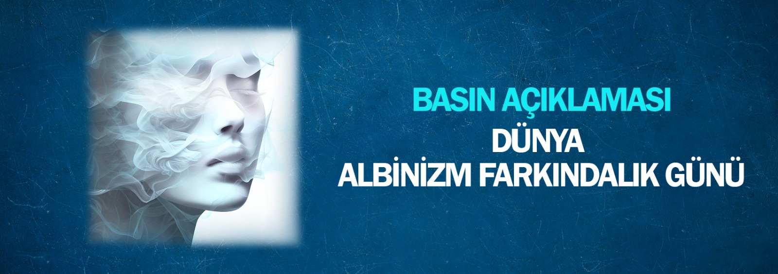 Dünya Albinizm Farkındalık Günü Basın Açıklaması