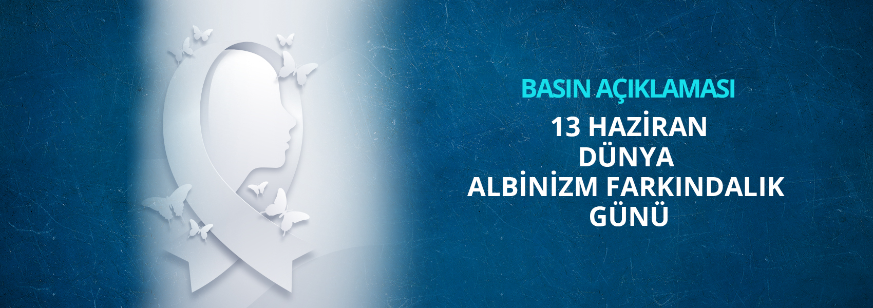 Dünya Albinizm Farkındalık Günü  Basın Açıklaması