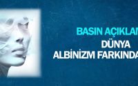 Dünya Albinizm Farkındalık Günü Basın Açıklaması